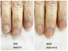 キアラネイル(Chiala nail)/自爪育成