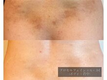 ル シーニュ/プロセルボディ