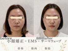 初回だけでもOK！しつこい勧誘無し！最短8回ではっきりわかる変化！