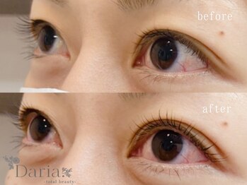 ダリア トータルビューティー(Daria. total beauty)/ラッシュリフト