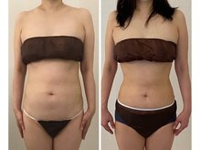 美人バスト 浜松店/【バストを残してダイエット★】