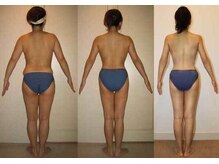 ジオリッチシフォン(giorich chiffon)/リジュべネーション全身7回結果