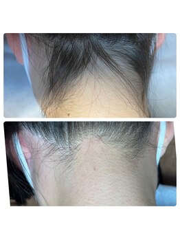 リアンジェ(Lianje)/一度でツルツル