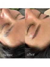 ルブール(levure)/圧倒的垢抜け