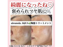 アルムダアクア 天王寺店(Aleumda AQUA)/ハーブピーリング/大阪/天王寺