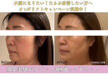 ラボーテアッシュ(La beaute H)