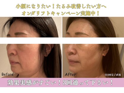 ラボーテアッシュ(La beaute H)の写真