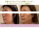 ラボーテアッシュ(La beaute H)の写真