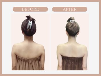 スリムライン 弘前店(The Slim Line)/before→after