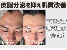 メンズのための肌管理◎都度払いで始めやすい