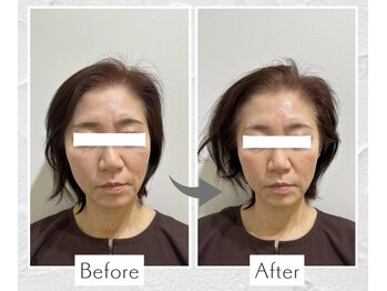 リノ ショウナン(LINO SHONAN)/LINO式ポテンツァ