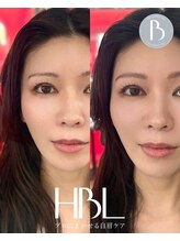 エラ アイブロウサロン(Ella eyebrowsalon)/眉毛wax + HBL