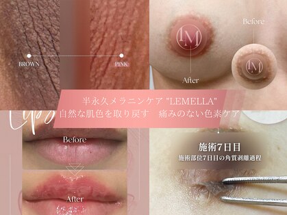 サロン イニ(SALON INI)の写真
