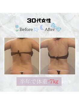 美 ワン(美 one)/痩身ダイエット