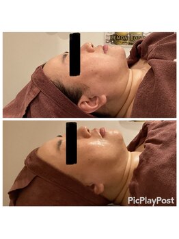 リッシュ(RICHE)/レモンボトル