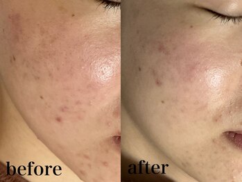 フェイシャルサロン アリイ(ALII)/