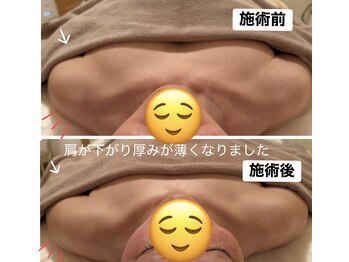 アロマセラピーサロン クオーレ(Cuore)/50代/背中の厚みスッキリ！