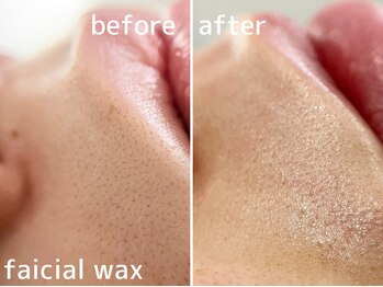 サルレ(Sarule)/フェイシャルワックス脱毛/眉毛