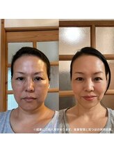 天使の耳/オーナー本人の変化