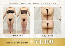 アンジュ(ange)