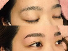 ジョアアンジェ 京橋店(joie ange)/【施術前後】HBL