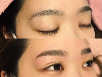 ジョアアンジェ 京橋店(joie ange)/【施術前後】HBL