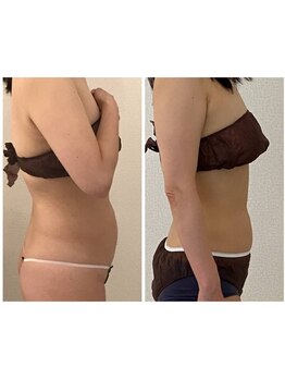 美人バスト 浜松店/【バストを残してダイエット★】