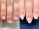 エーネイル(a nail)の写真/深爪さんからの3ヶ月！独自の技法でオフケア～仕上がりのフォルムまでこだわります！