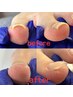 つらい足のトラブルでお悩みの方！