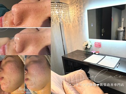 ベルーチェ(Beluce)の写真