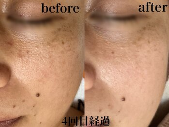 フェイシャルサロン アリイ(ALII)/