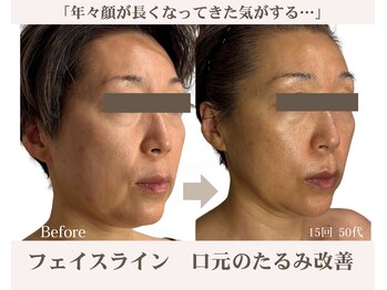 アンジェリカ(Angelica)