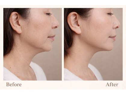 クラルスシンメトリーサロン 高槻店(Clarus Symmetry Salon)の写真