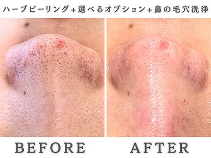 レヴィア(Revia)の写真