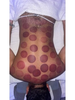 中国整体 らくらく堂/温熱療法基本体温アップ大事