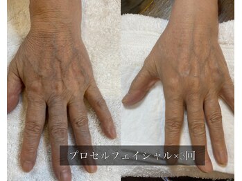 ル シーニュ/プロセルボディ