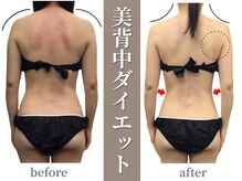 ステイゴールド美容整体院(STAY GOLD)の雰囲気（40代女性の背中・お腹・肩こり腰痛・骨盤肩甲骨まわりをスッキリ）