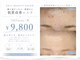 エピル(EPIL)の写真