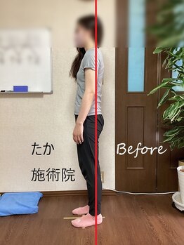 たか施術院/腰痛 関節の痛 めまい 初～1ヶ月