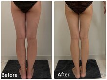 ナビ(NABI)/セル脂肪撃退で足長効果◎