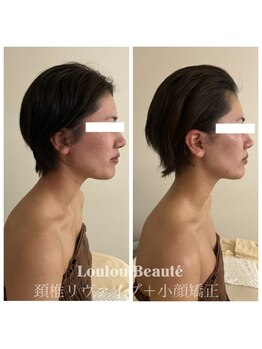 ルルボーテ(Loulou Beaute)/頭蓋骨調整+小顔矯正