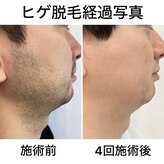 シャイニースキン(Shiny skin)