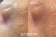 エンソワー(en'sower)