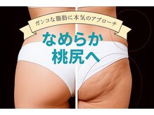 フィールカーム(feel calm)の雰囲気（触れたくなる！柔らか美尻に丸みとハリのあるヒップへ導く）
