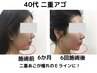 【二重アゴを撃退！】“太って見える”を徹底改善 美輪郭リフト初回体験