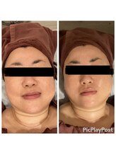 リッシュ(RICHE)/レモンボトル4cc