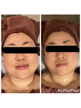 リッシュ(RICHE)/レモンボトル4cc