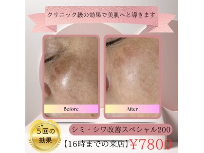 ゼロ(ZERO)の写真