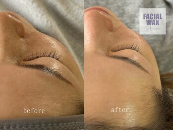 メレラ(melera)/マリムーブフェイシャルワックス