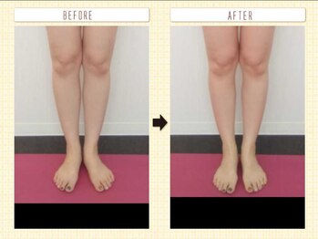 エステアンドトレーニング ビビ(ViVi)の写真/【美脚革命】筋膜リリースで血流を良くし、冷えや疲労を改善☆むくみスッキリ！スラっとした憧れの美脚へ